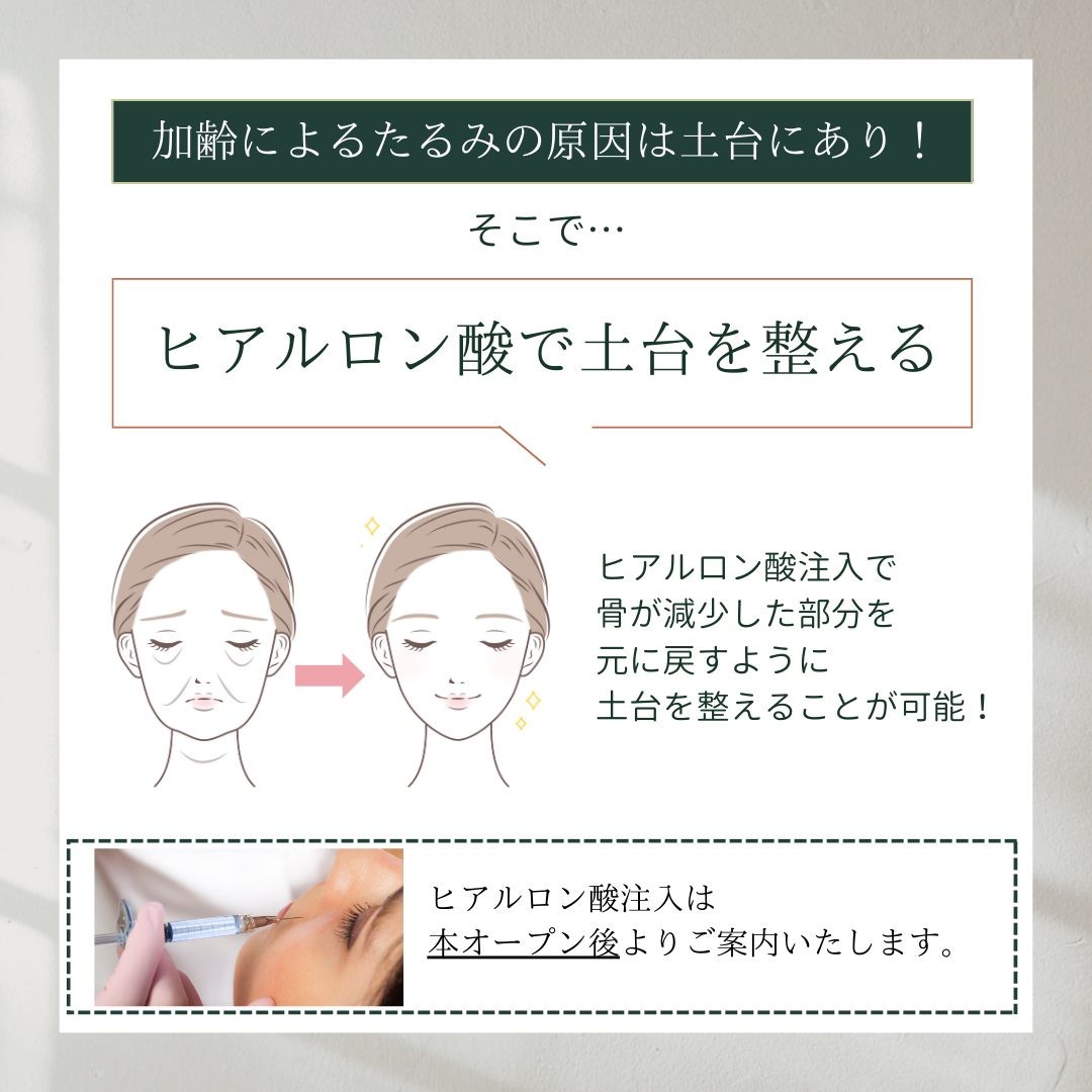 ヒアルロン酸でできるたるみへのアプローチの説明