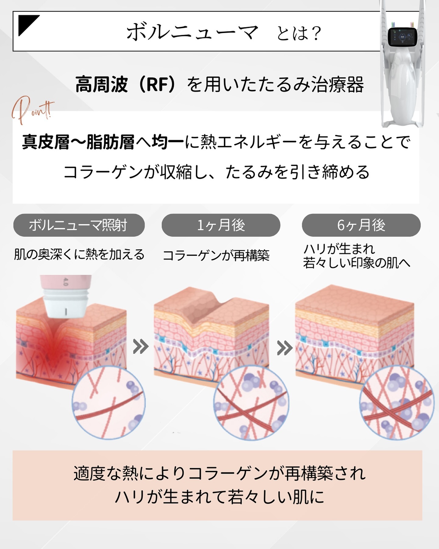 ボルニューマとは