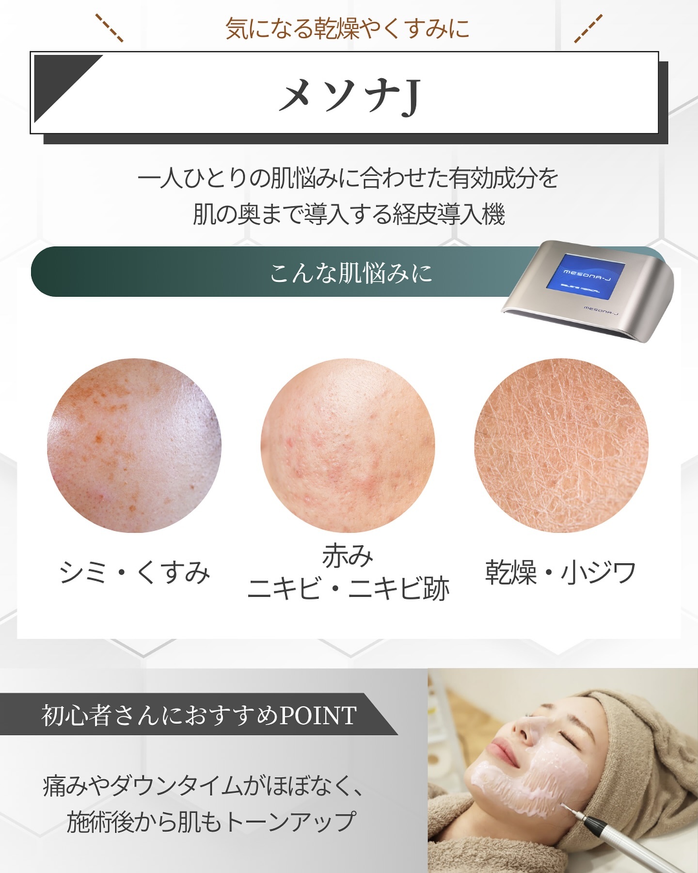 メソナJ