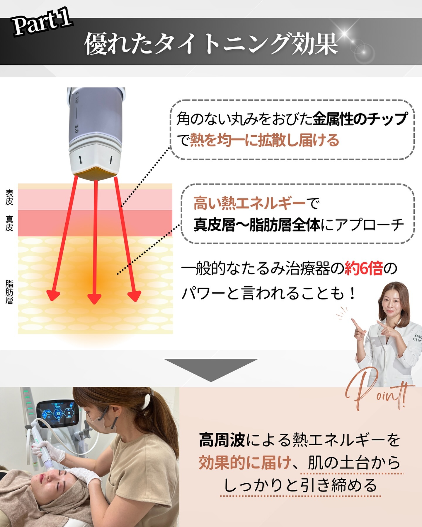 ボルニューマの仕組み