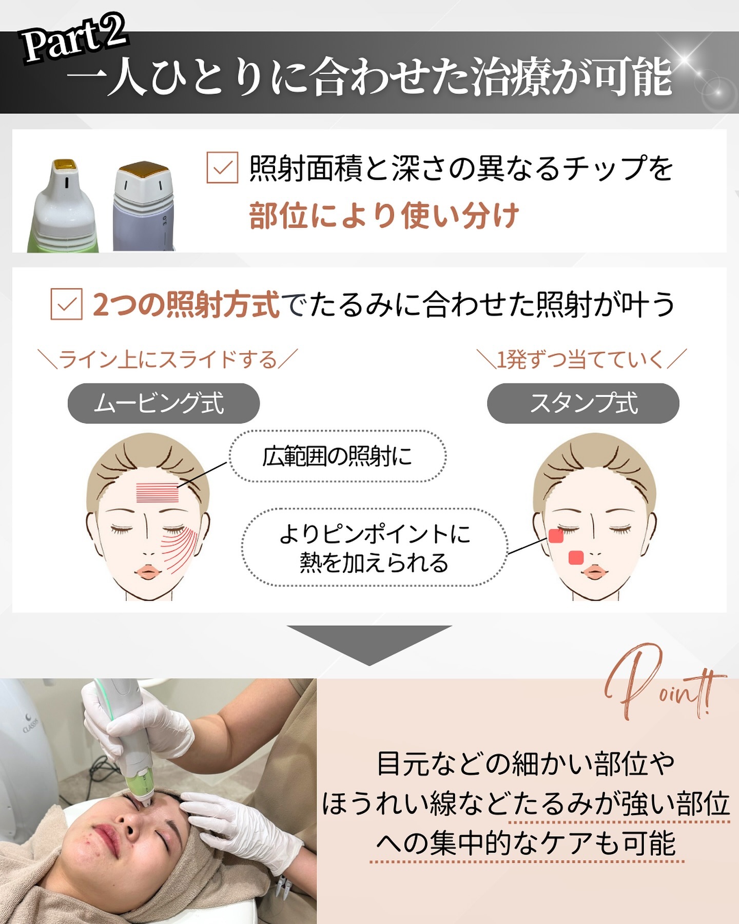 ボルニューマのチップと照射方法