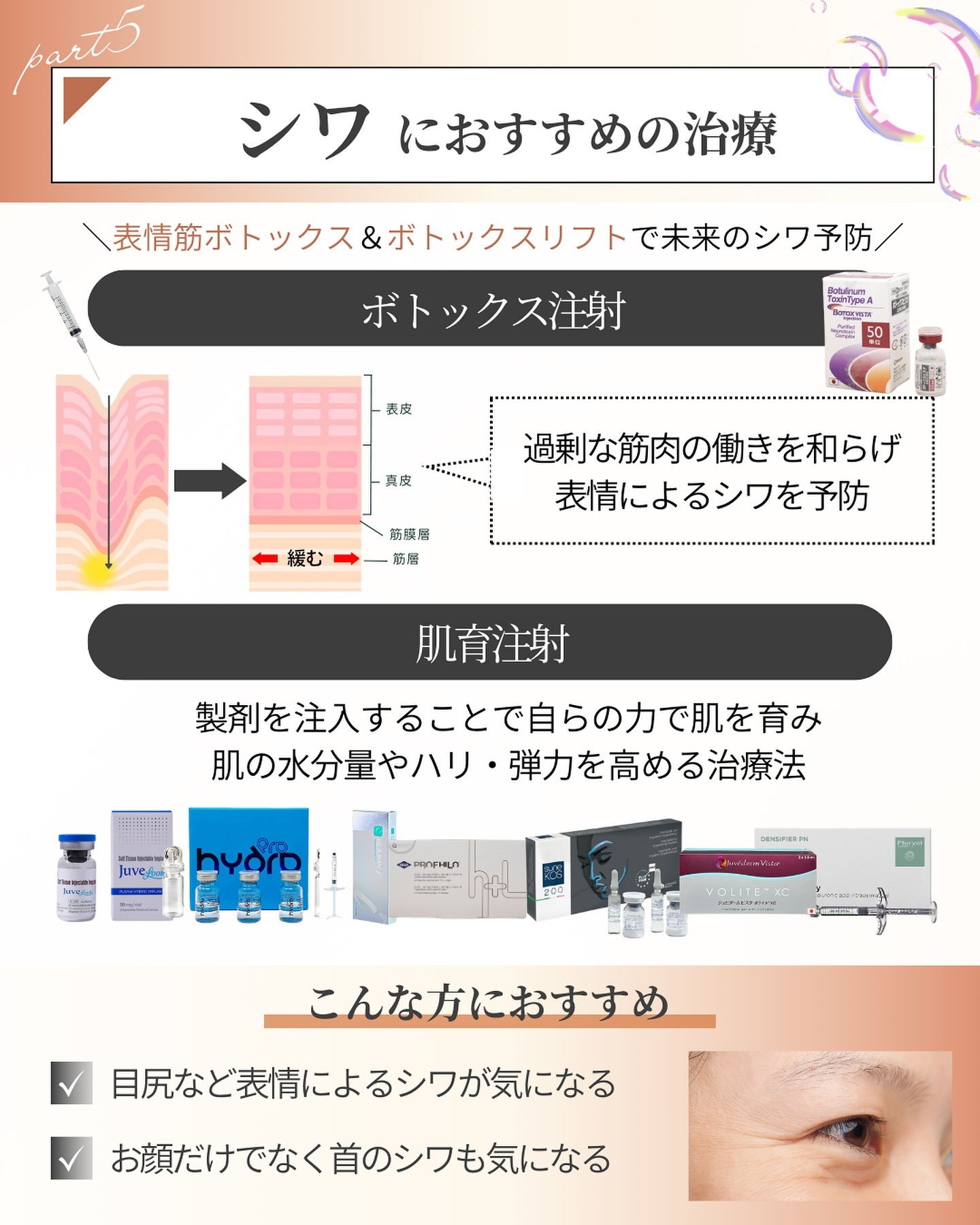 シワにおすすめの施術2選