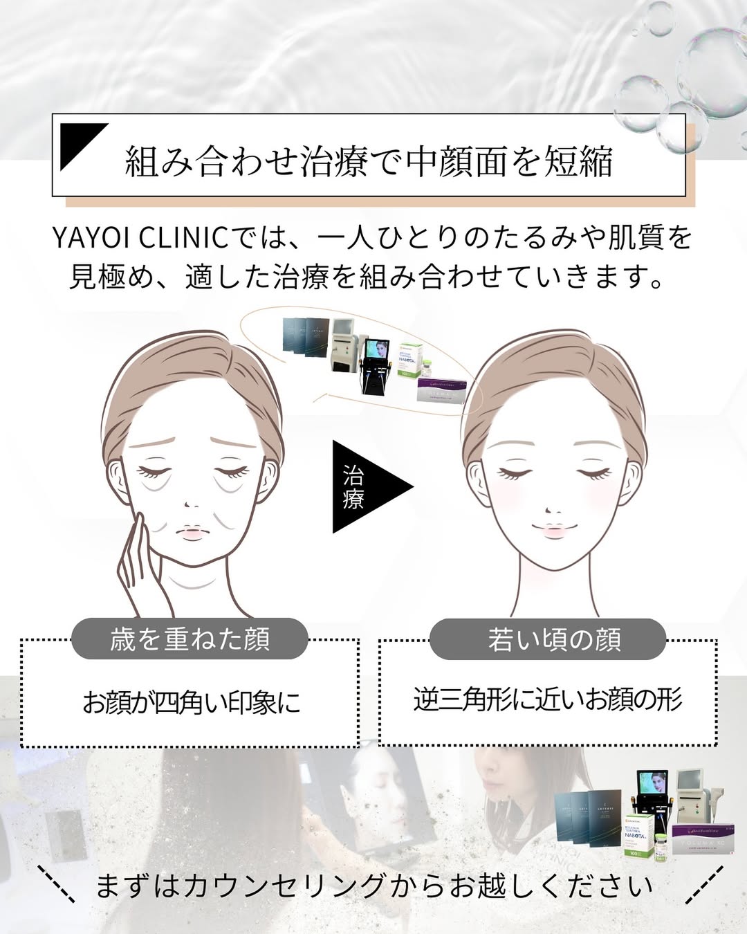 組み合わせ治療