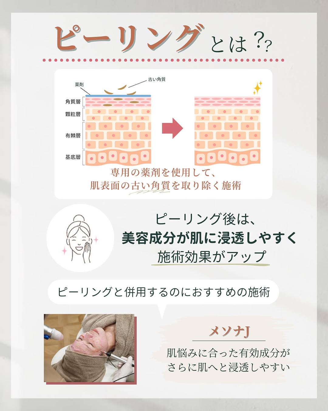 ピーリングとは？