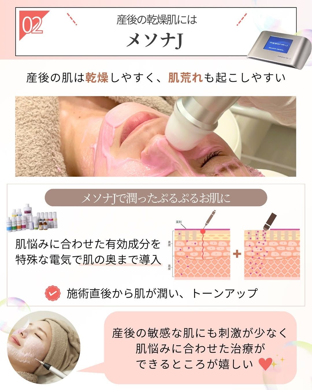 産後の乾燥肌を改善に導くメソナJ