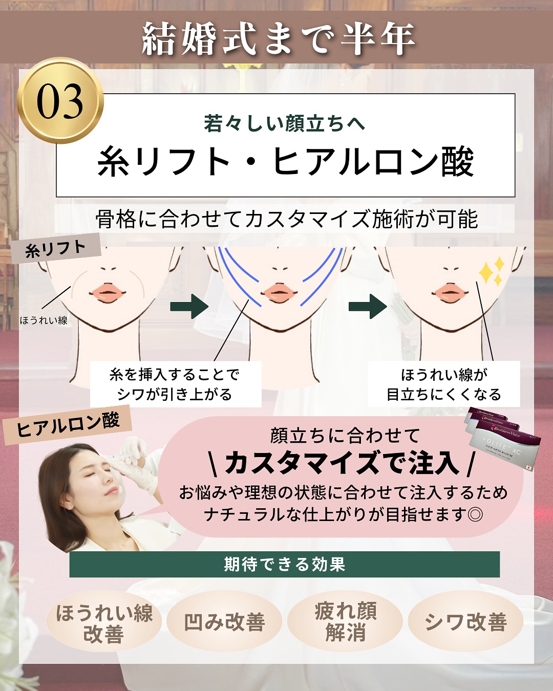 糸リフト・ヒアルロン酸