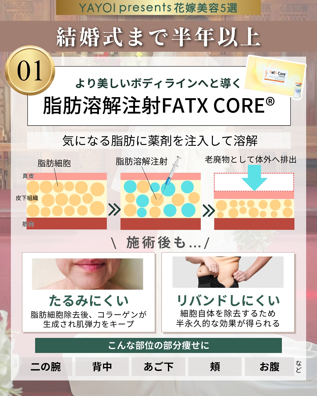 脂肪溶解注射FATX CORE®