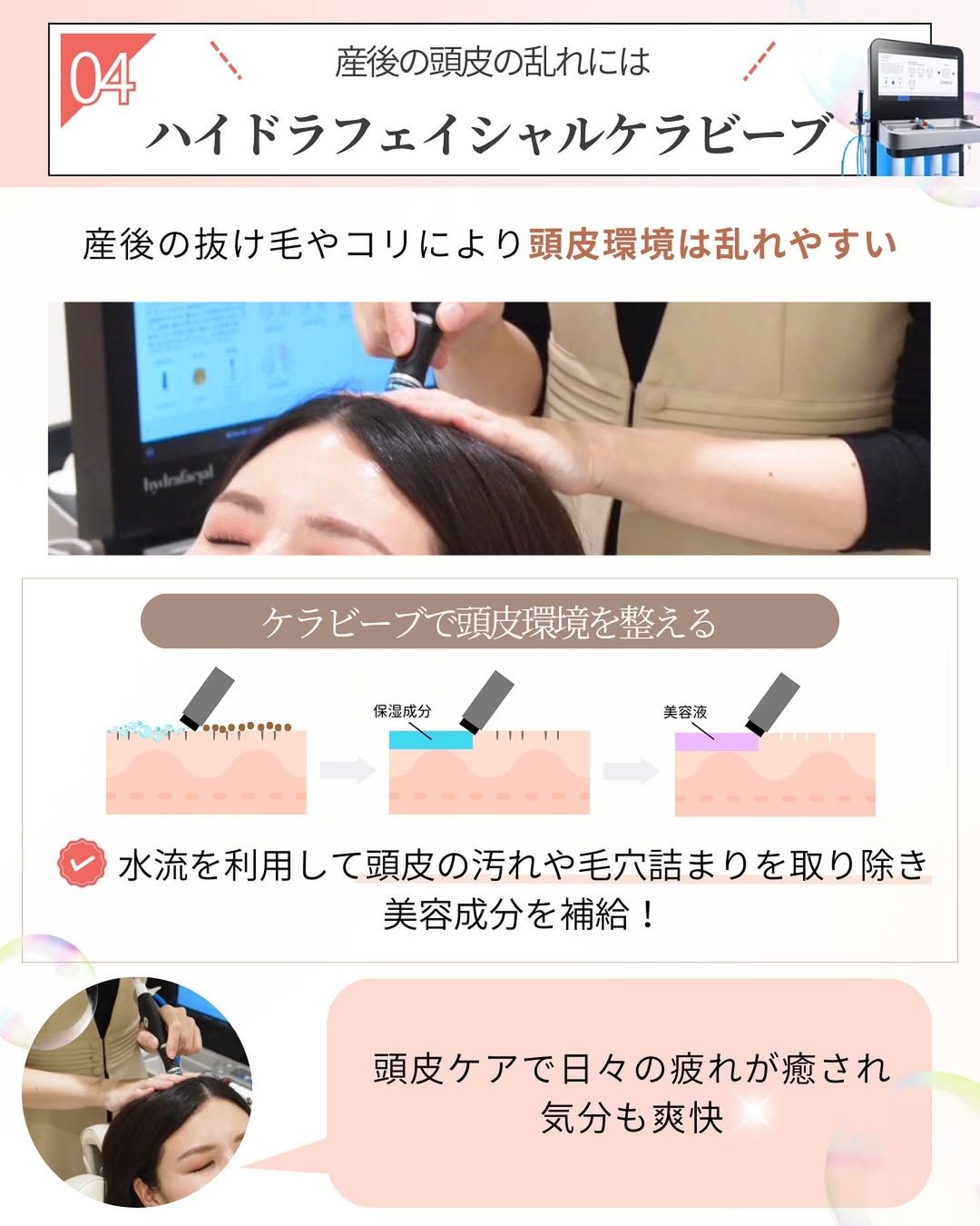 頭皮環境を整えるハイドラフェイシャルケラビーブ