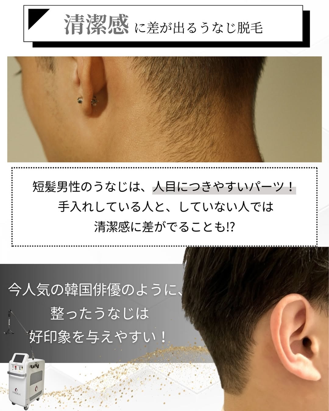 清潔感に差が出るうなじ脱毛
