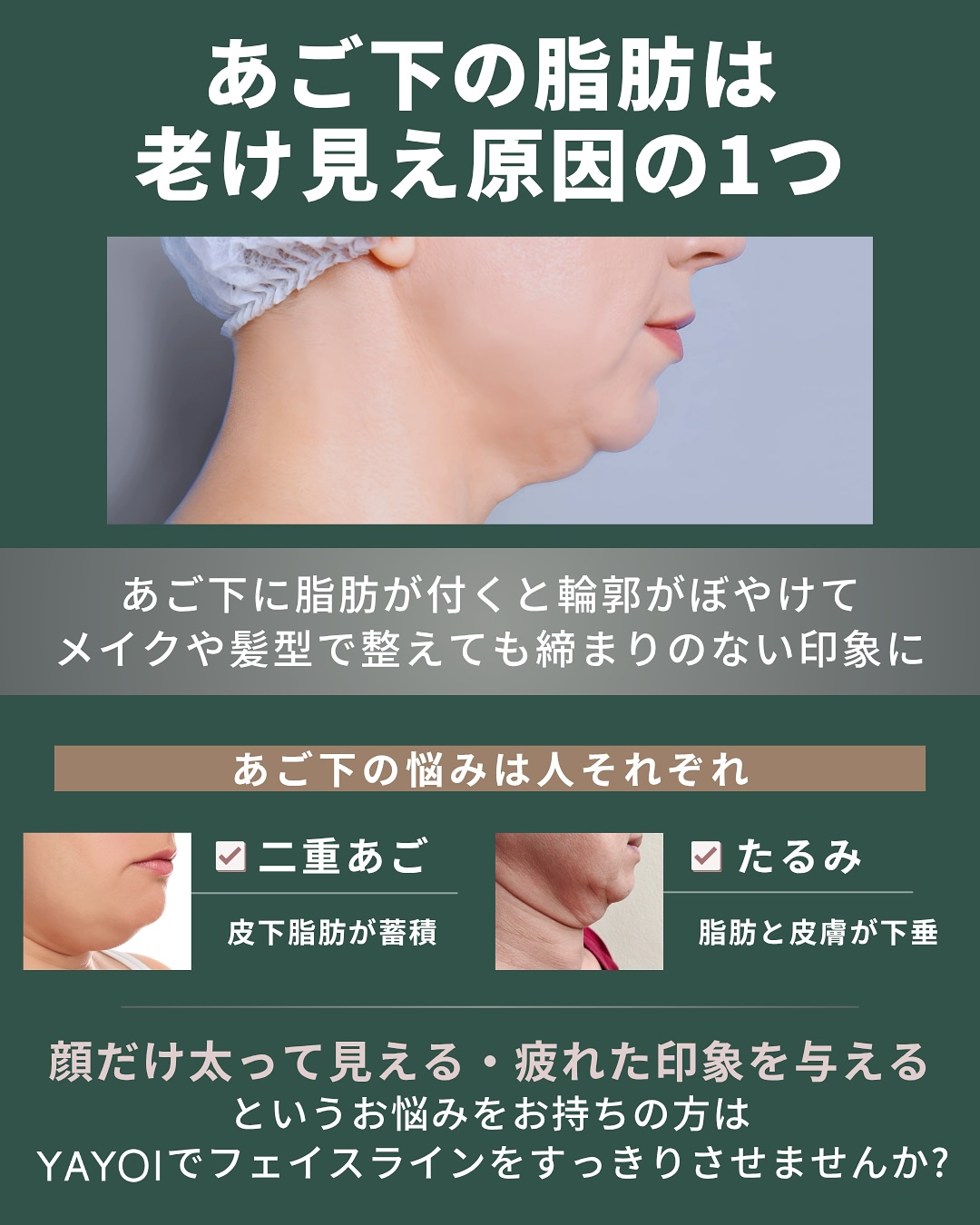 あご下の脂肪老け見え原因