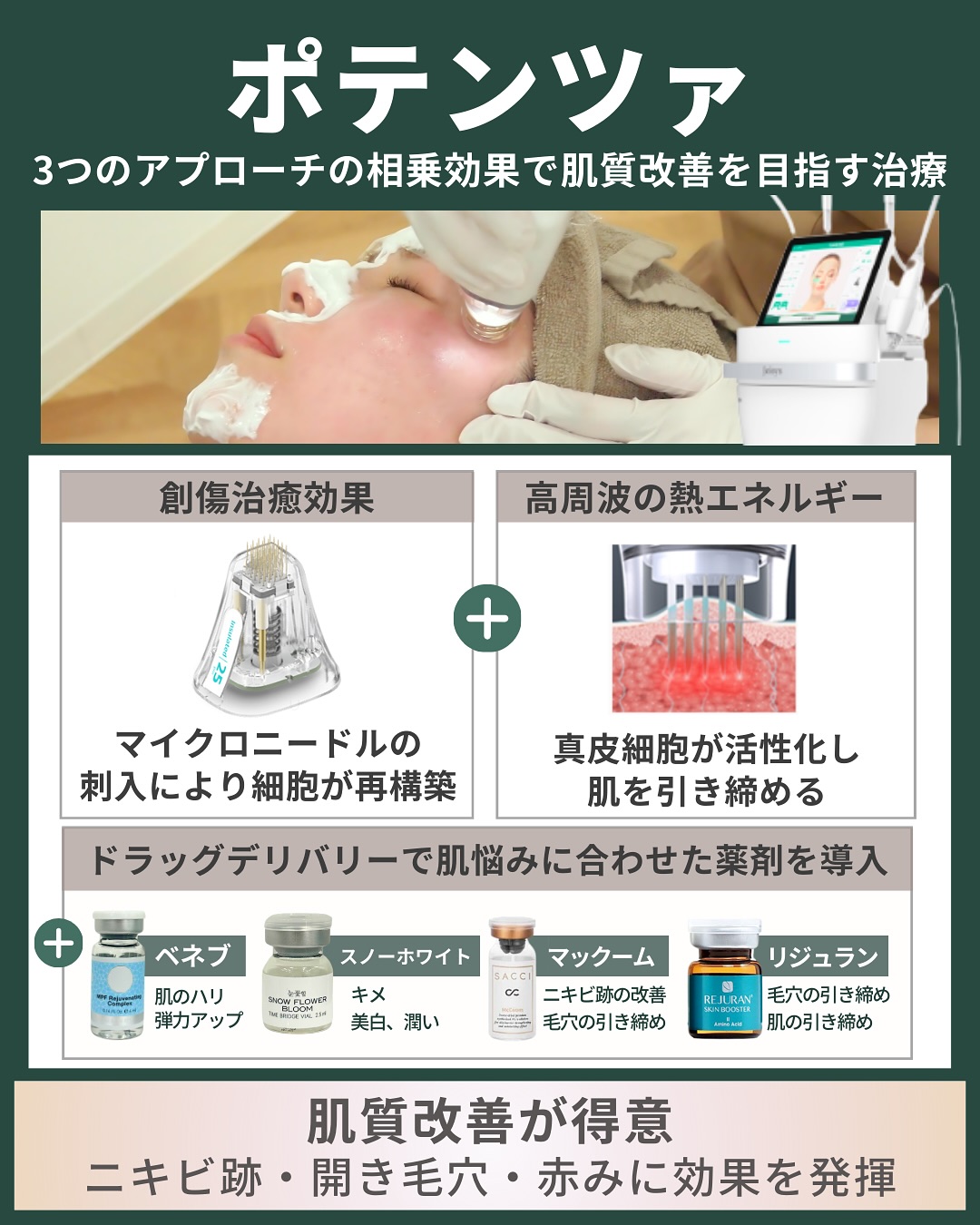 ポテンツァ