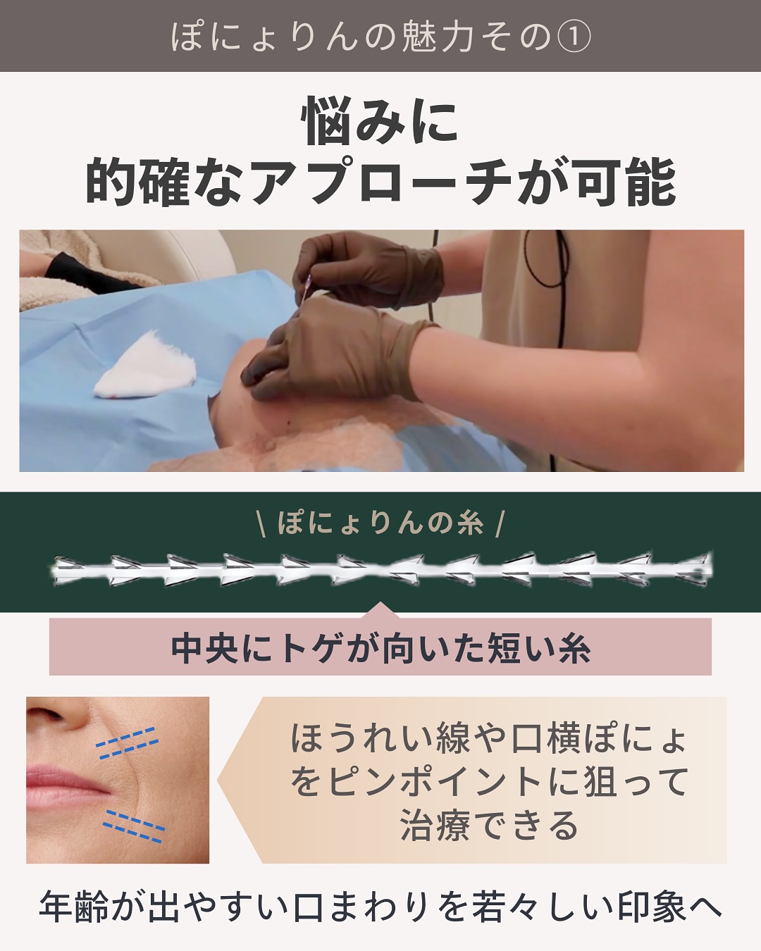 ぽにょりん 悩みに的確にアプローチ