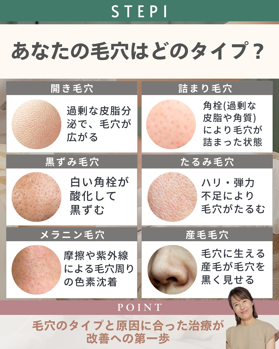 毛穴タイプ