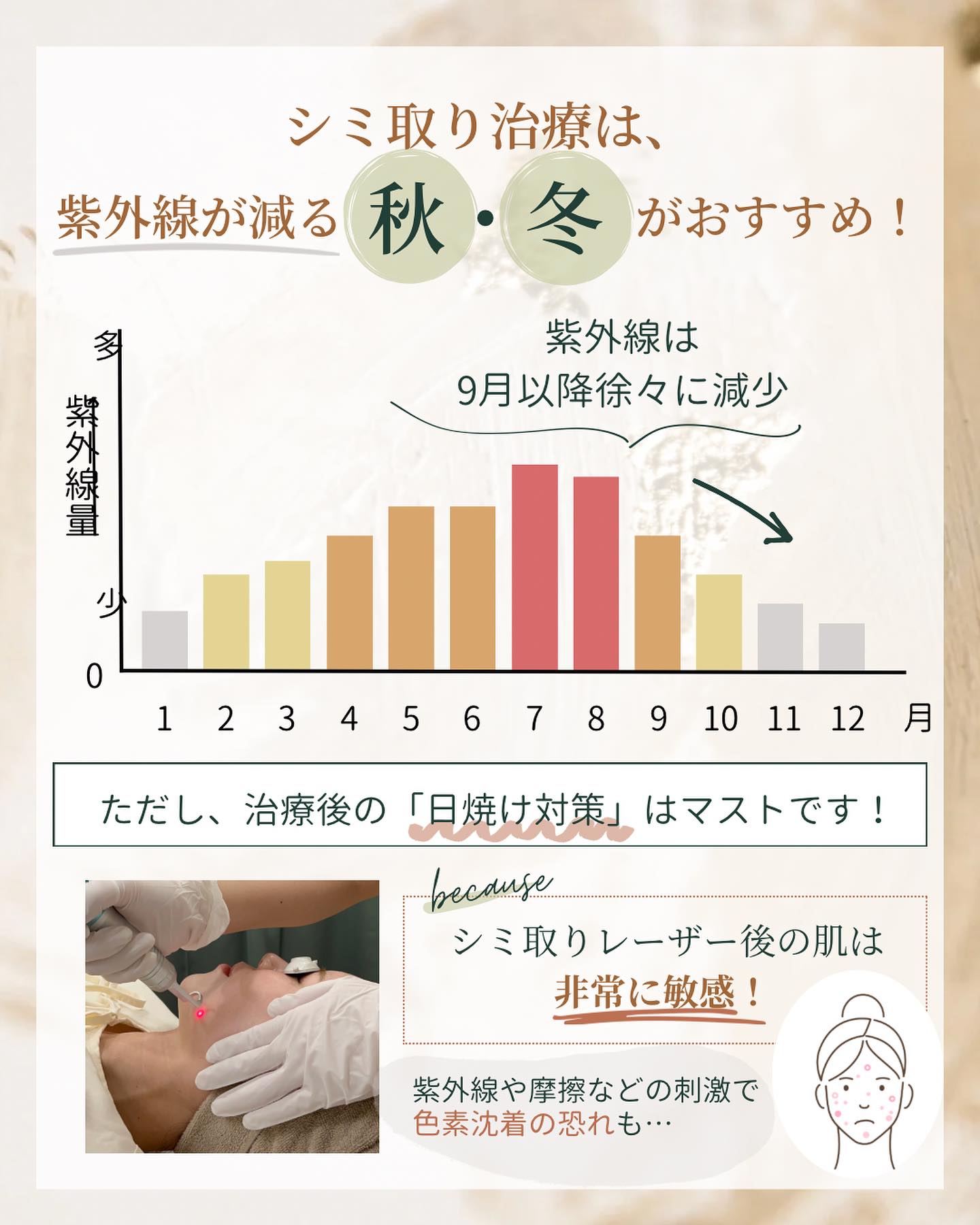 シミ取りに適した季節は秋冬
