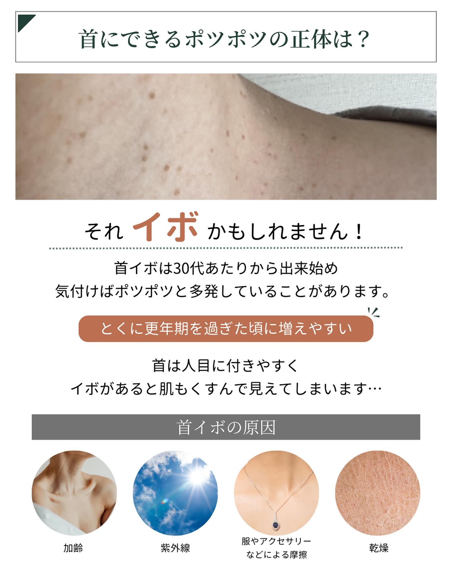 首イボの原因