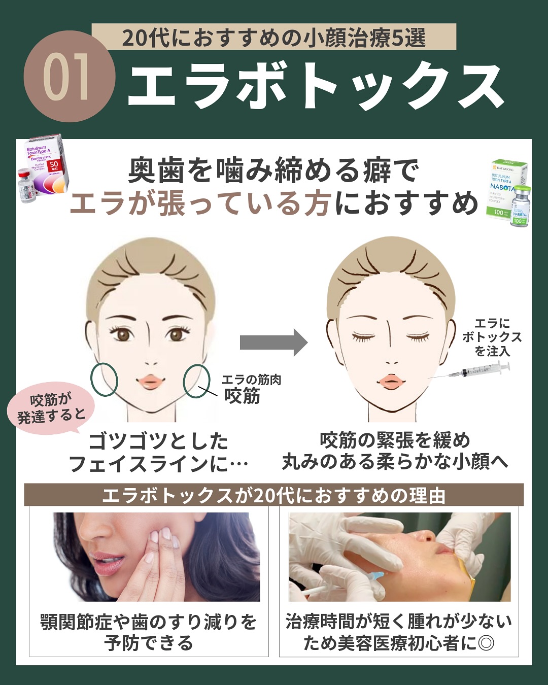 （1）エラボトックス