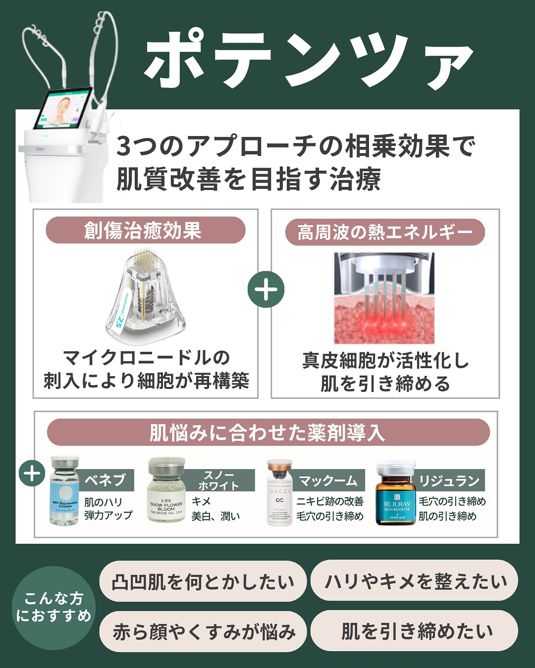 ポテンツァ