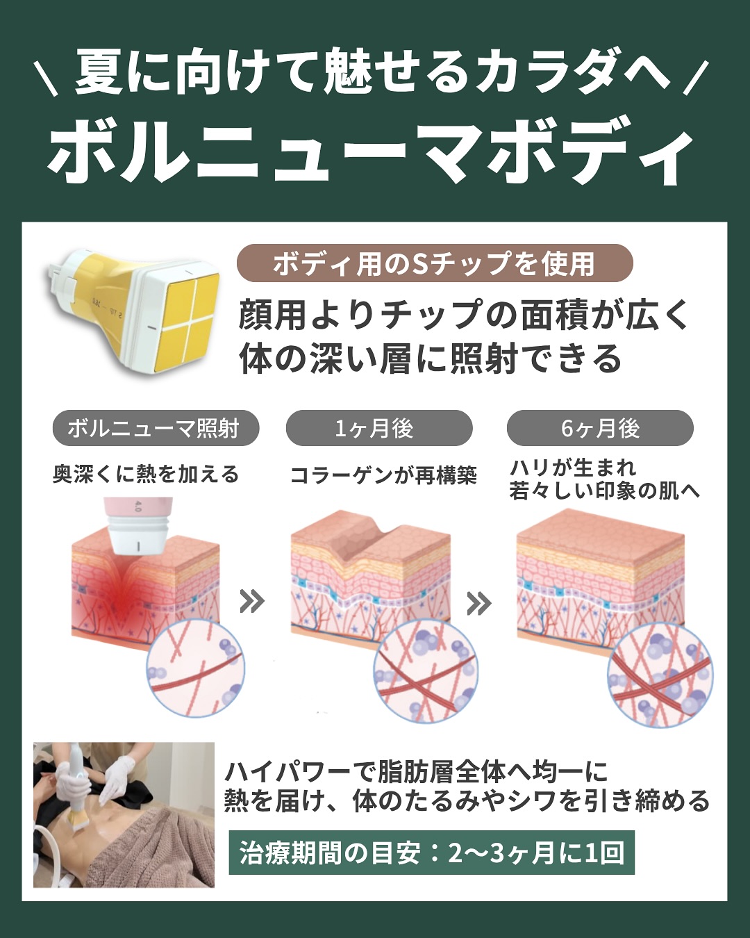ボルニューマボディ