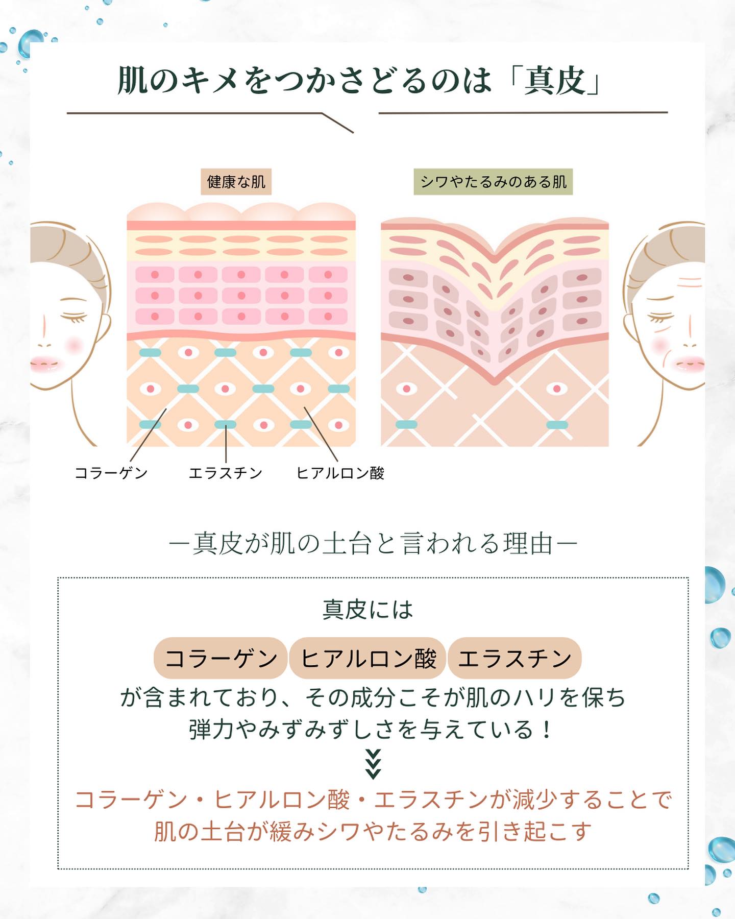 真皮　シワ　たるみ
