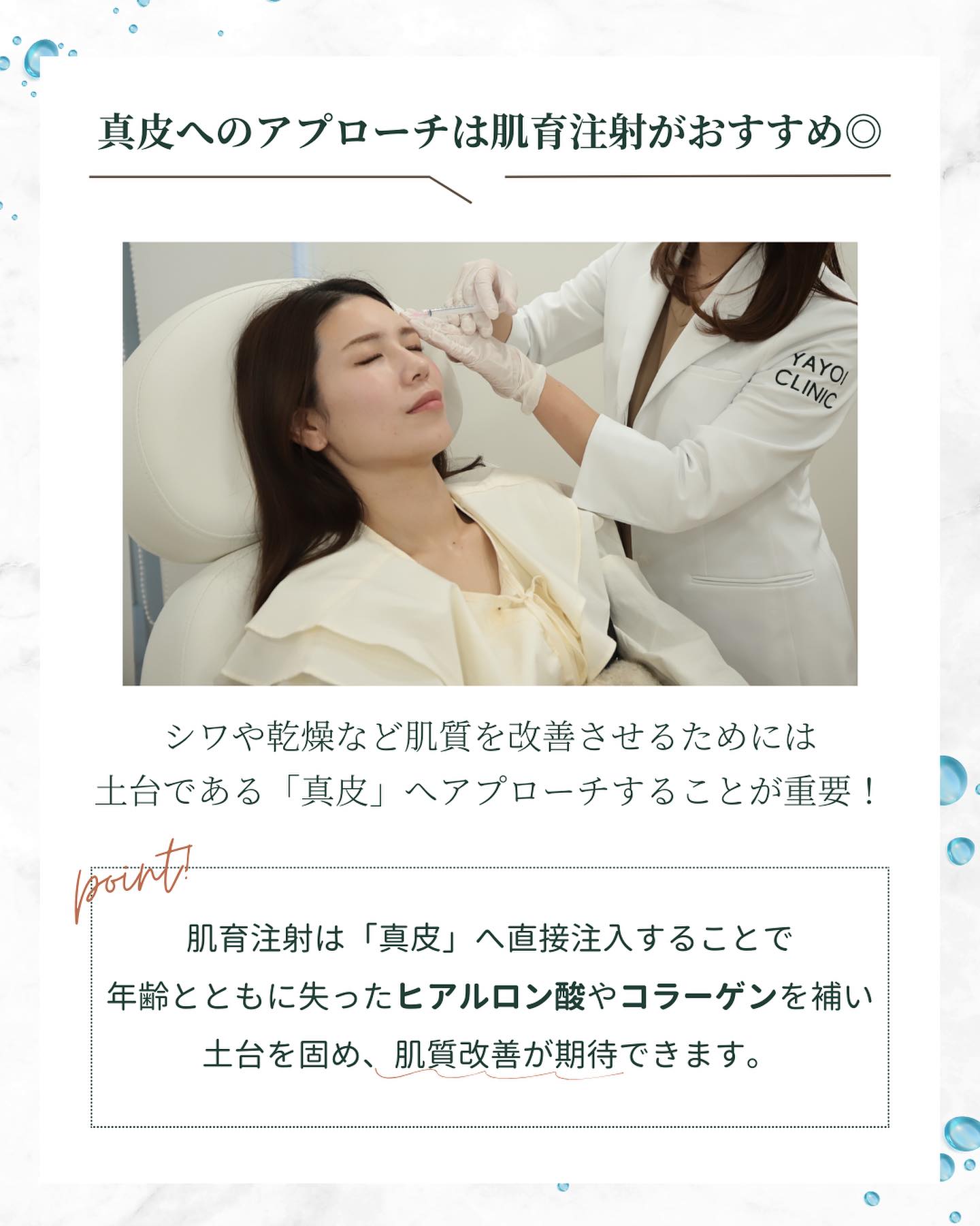 真皮　肌育注射