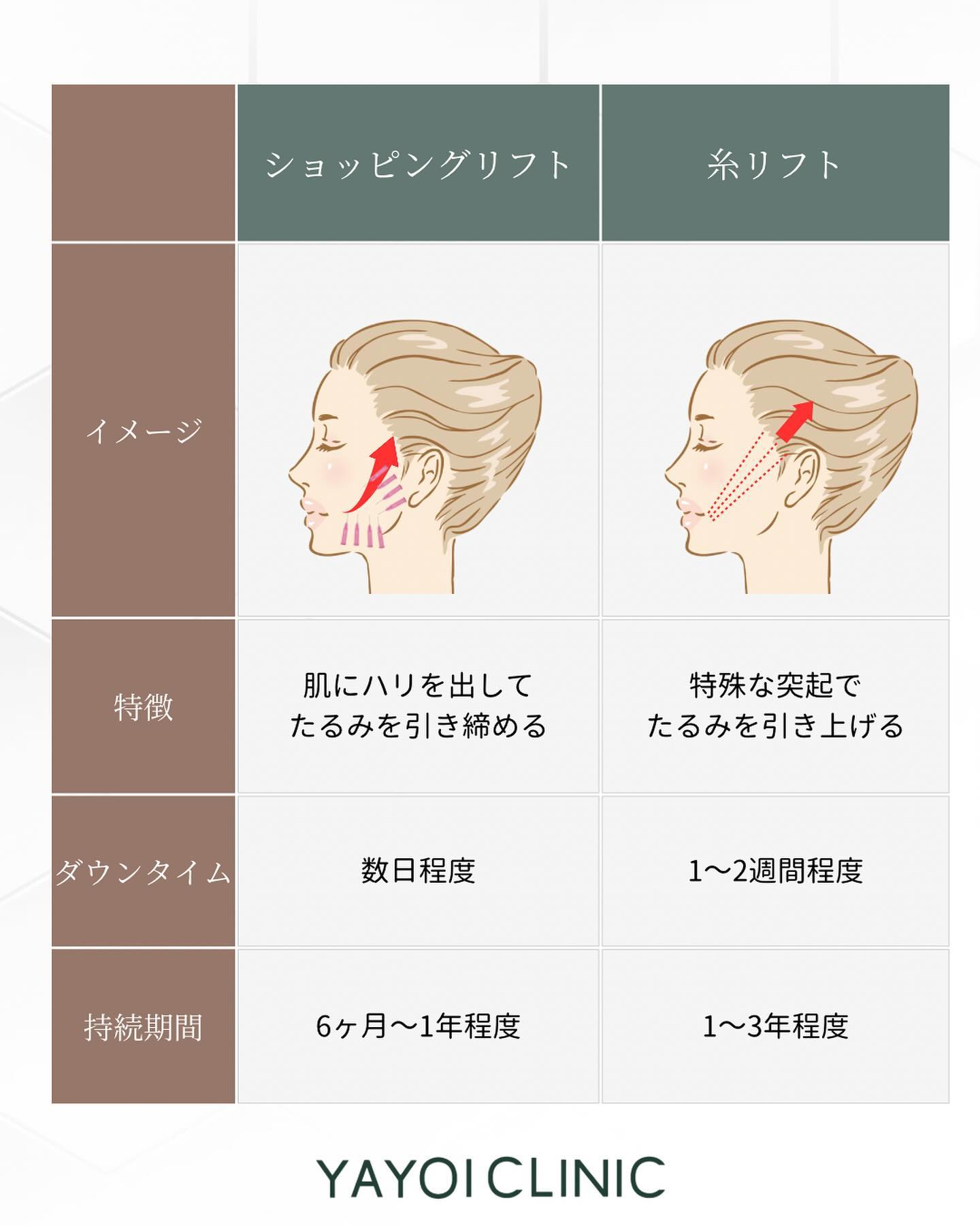 ショッピングリフト 糸リフト 違い