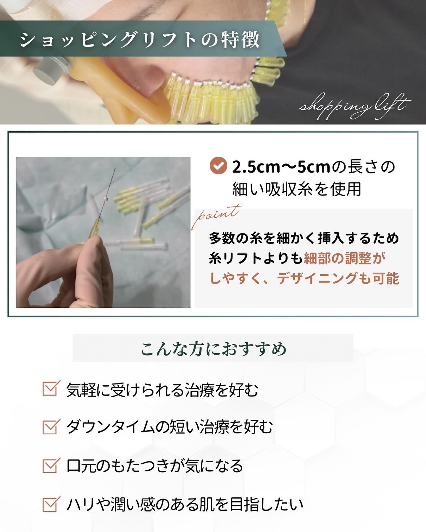 ショッピングリフト 特徴