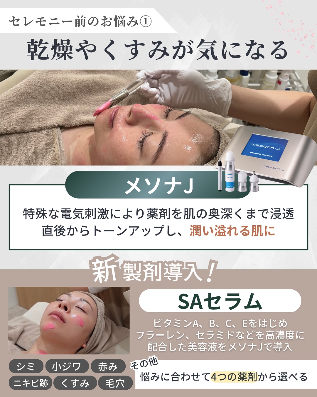 メソナJとは