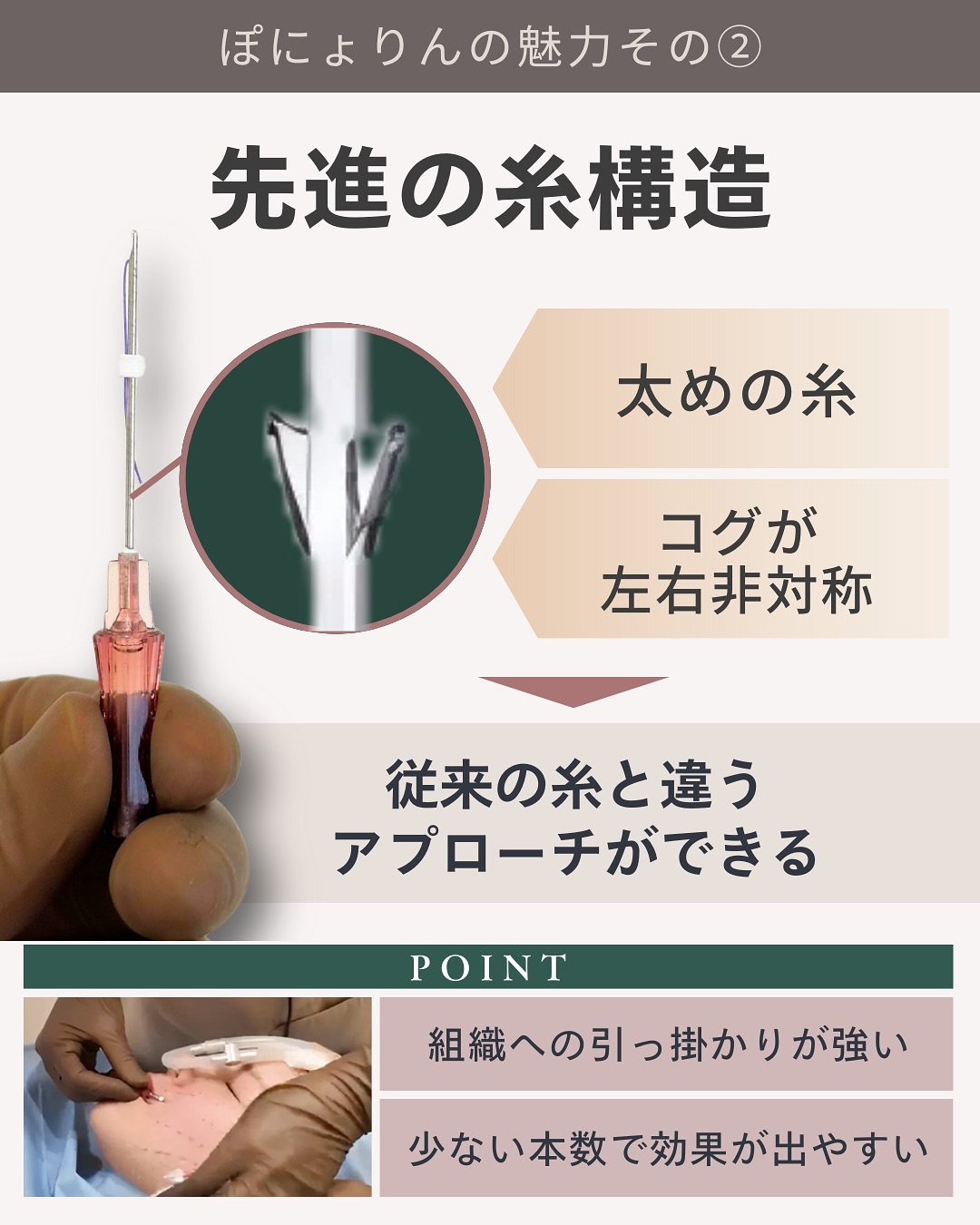 ぽにょりん 先進の糸構造