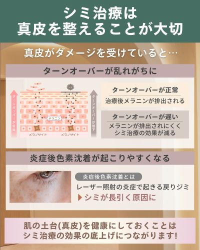 シミ取りは真皮を整えることが大切