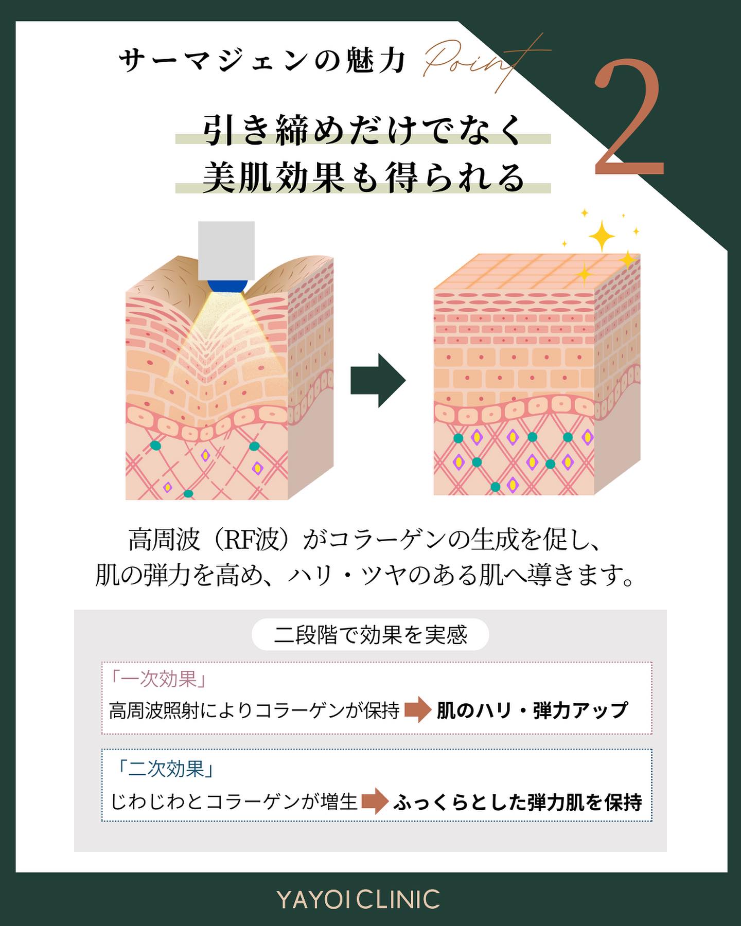サーマジェンの魅力｜美肌効果に期待できる