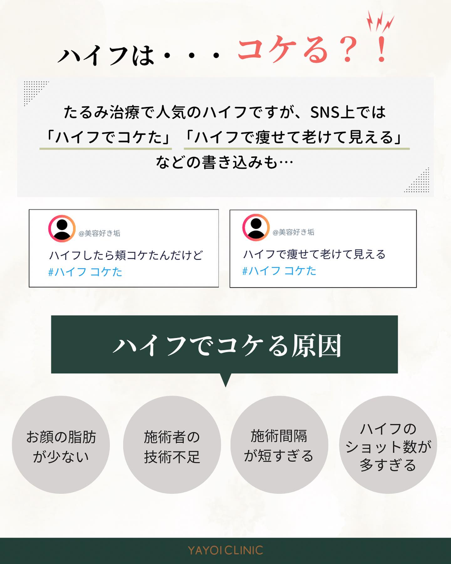 ハイフ 頬骨 目立つ