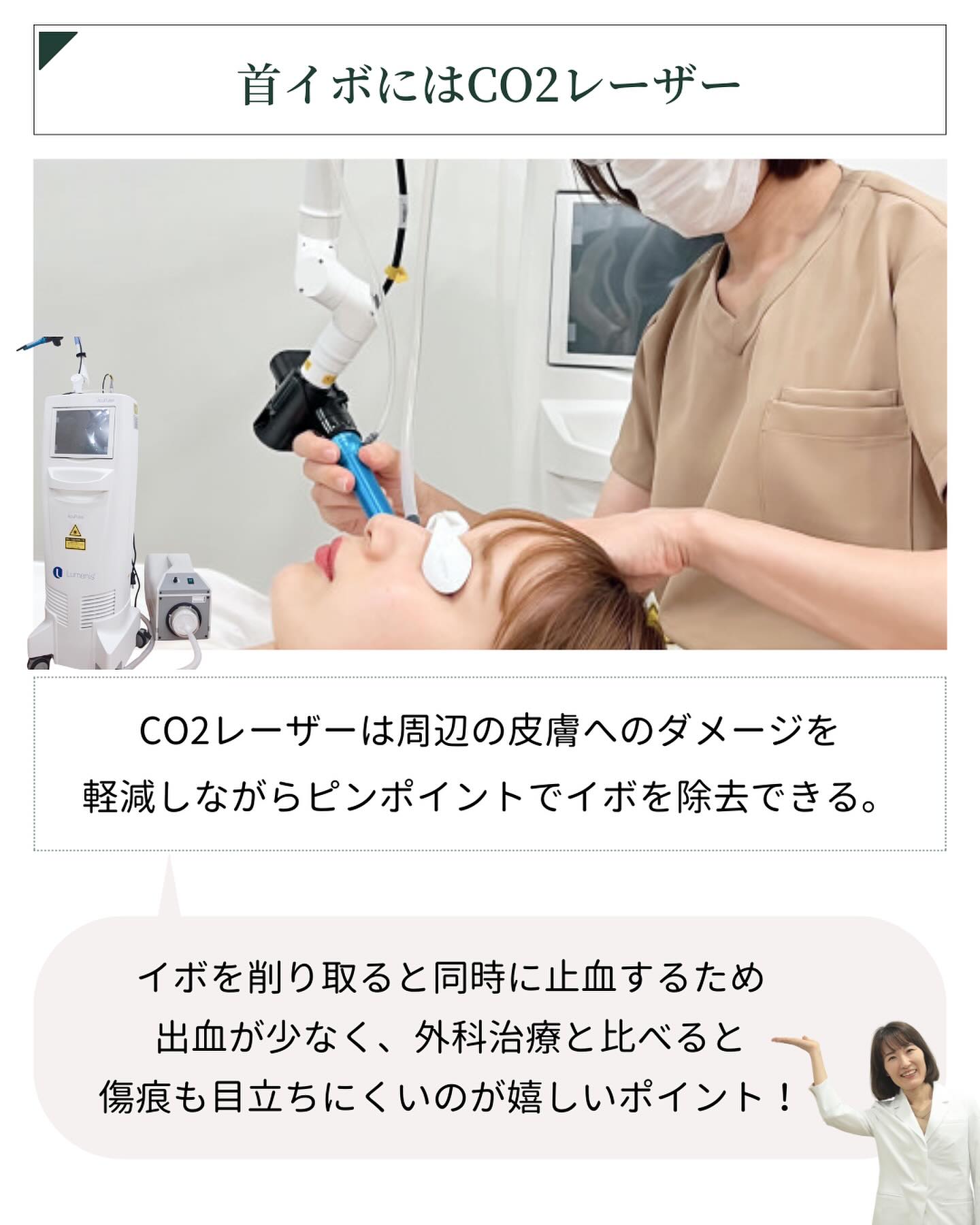 首イボ CO2レーザー