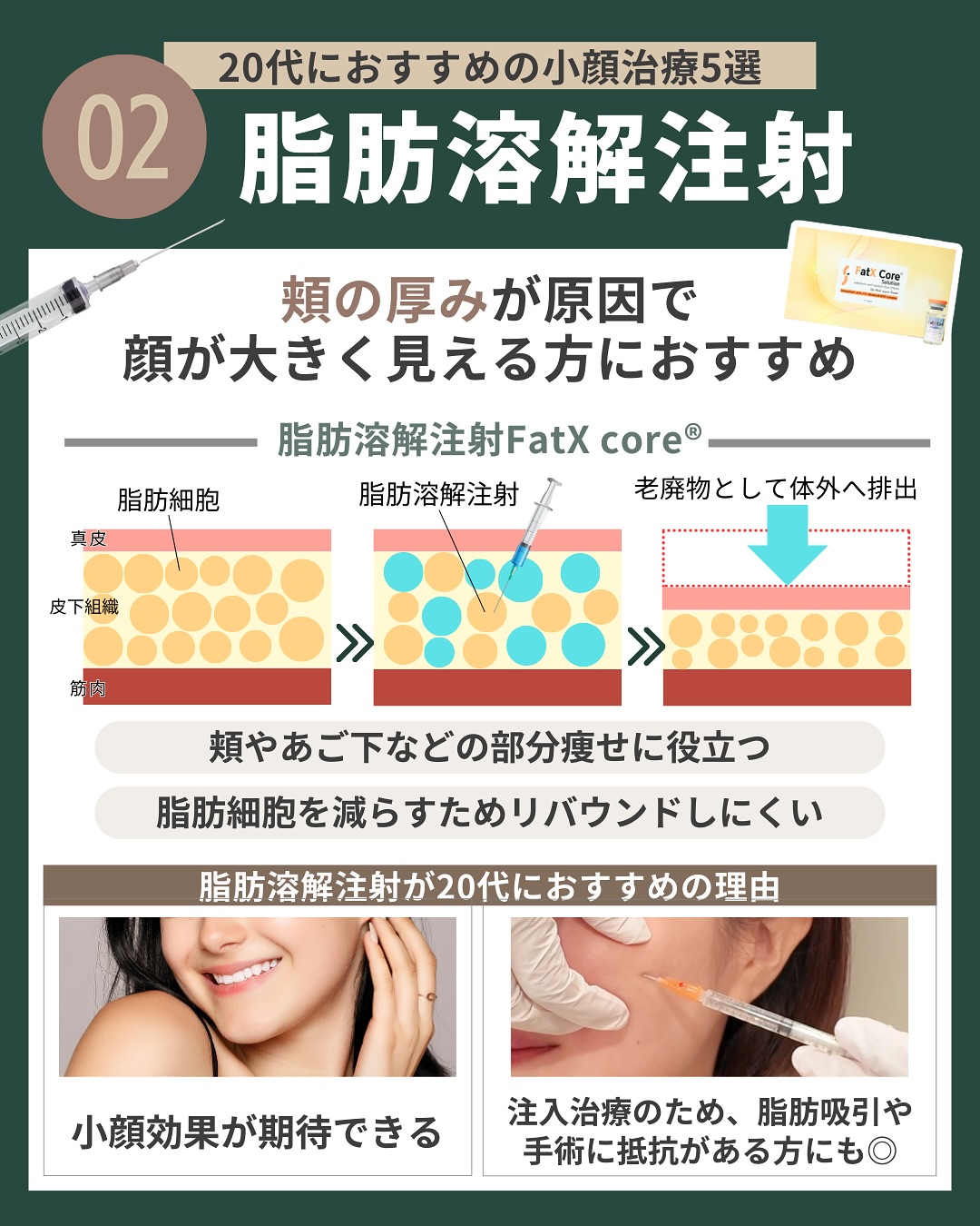 （2）脂肪溶解注射