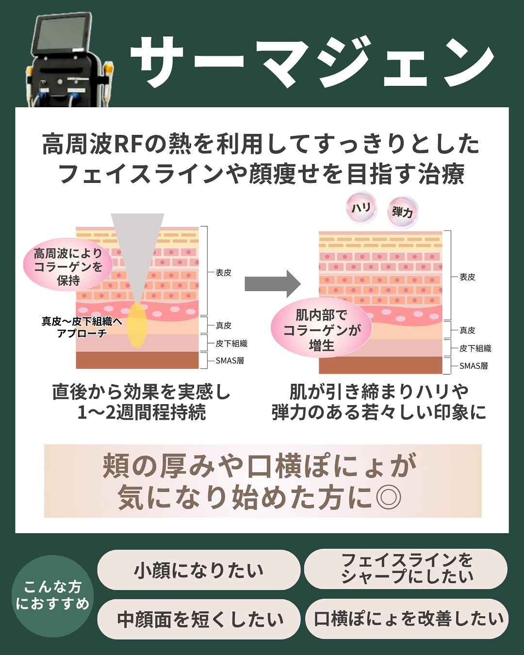 サーマジェン