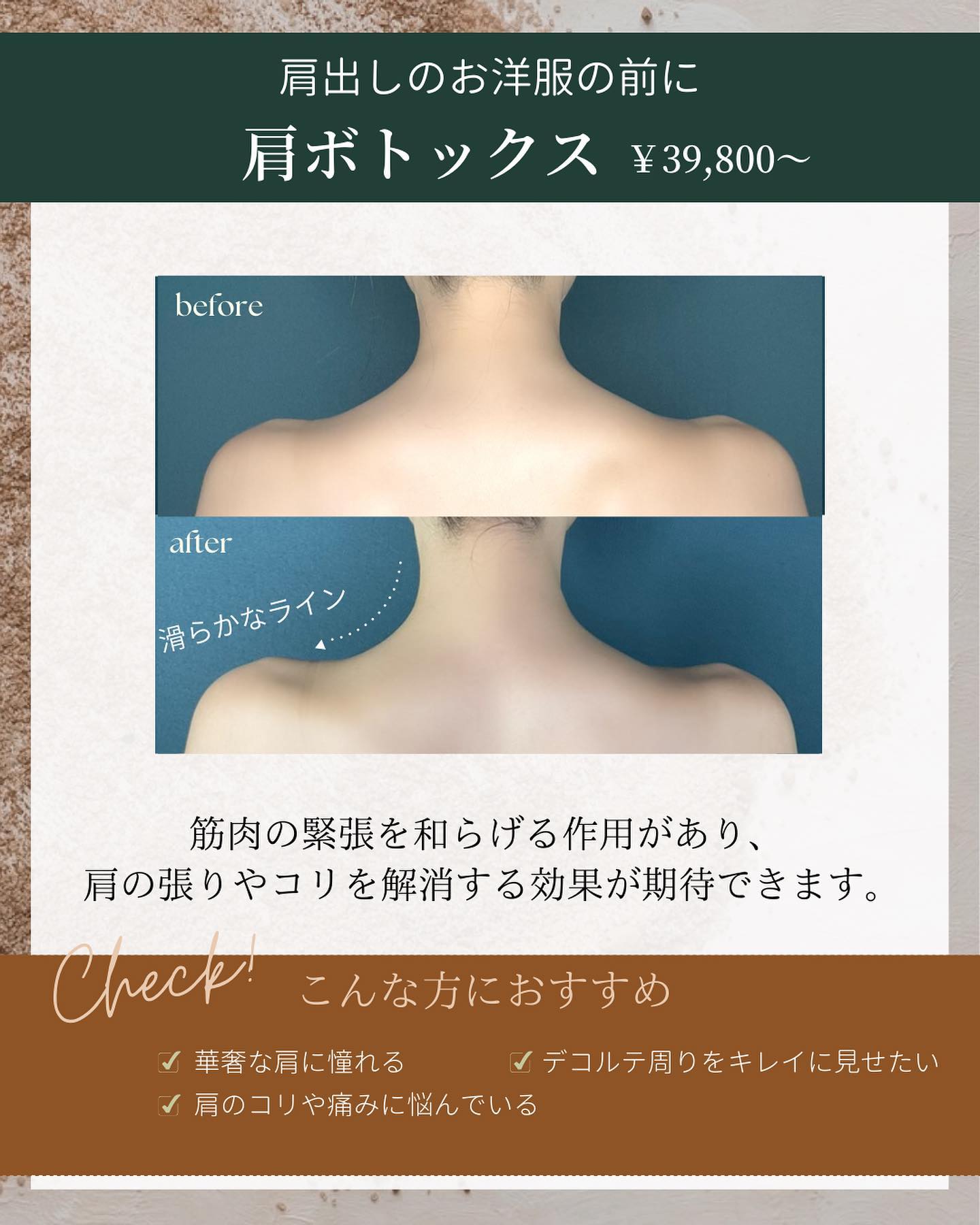 肩ボトックス注射の料金と期待できる効果