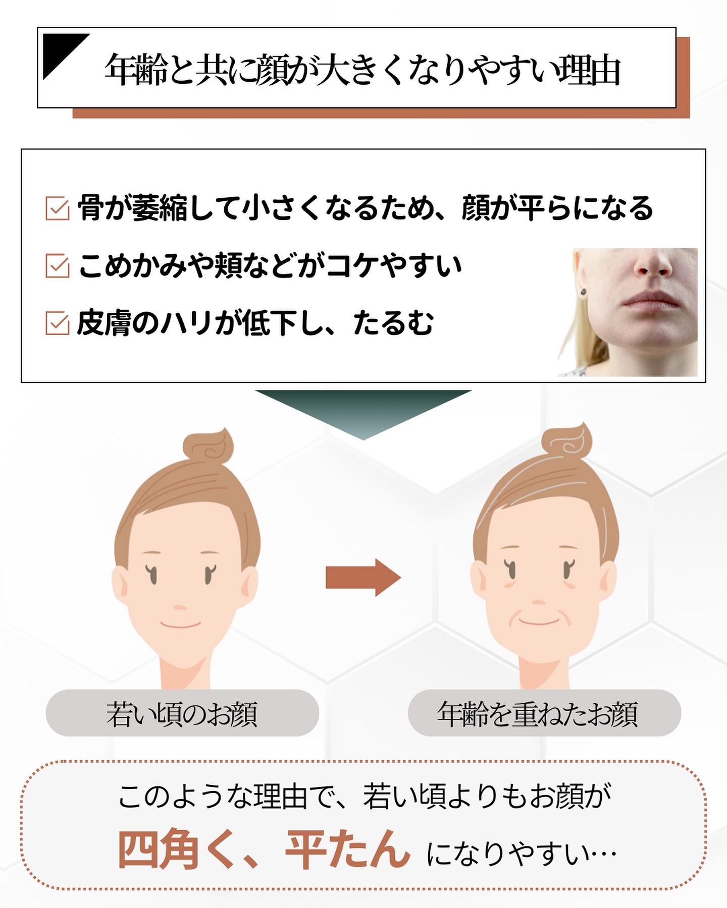 加齢　顔が大きくなる