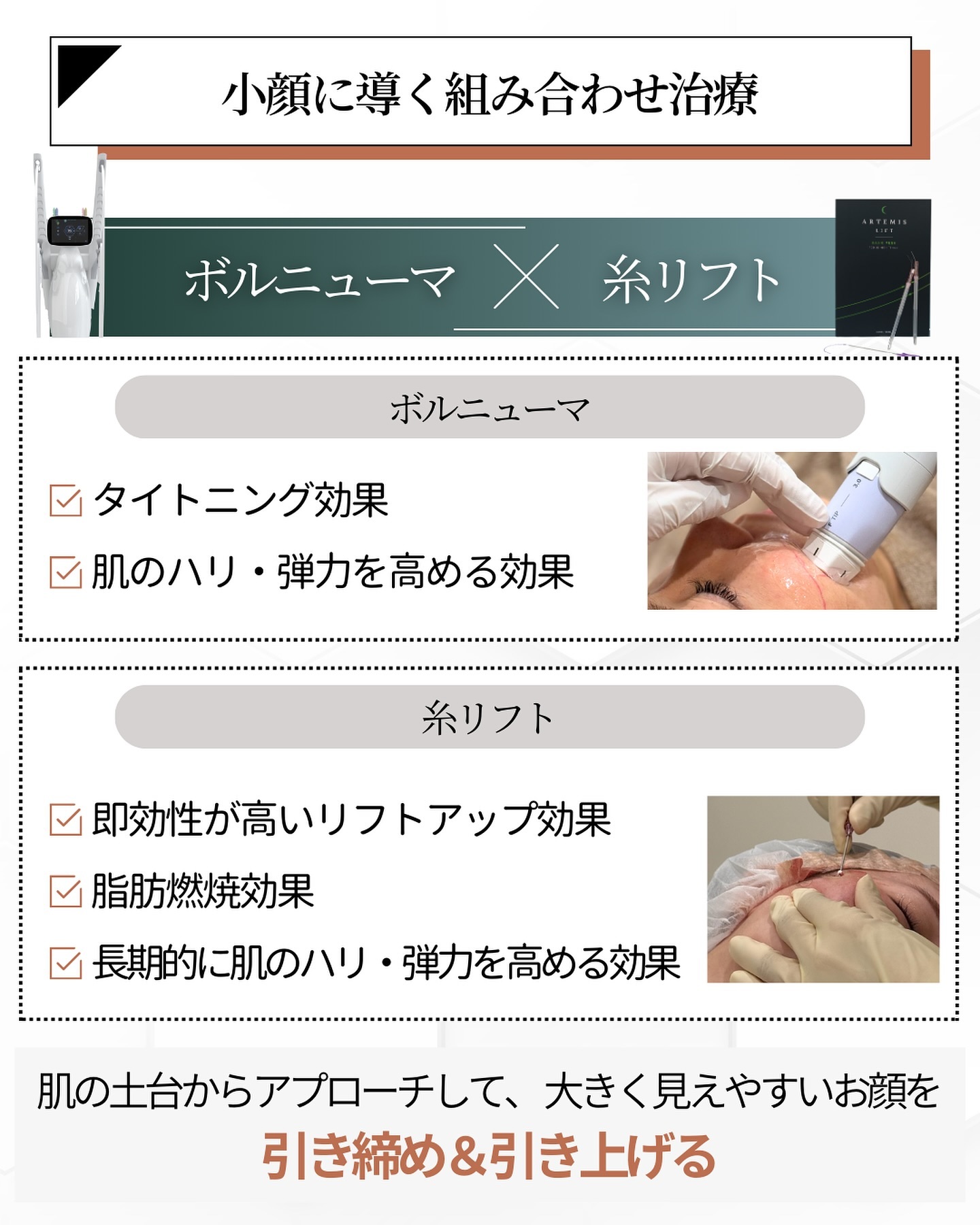 ボルニューマ　糸リフト　小顔