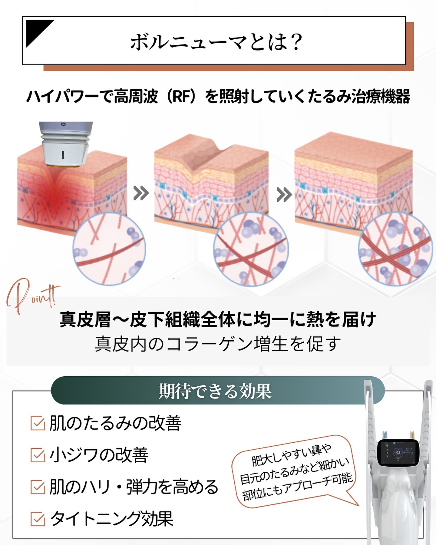 ボルニューマ　とは