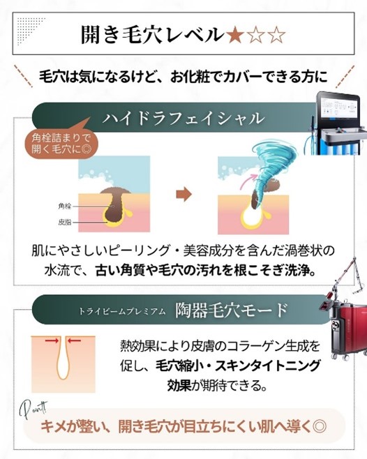 開き毛穴レベル1