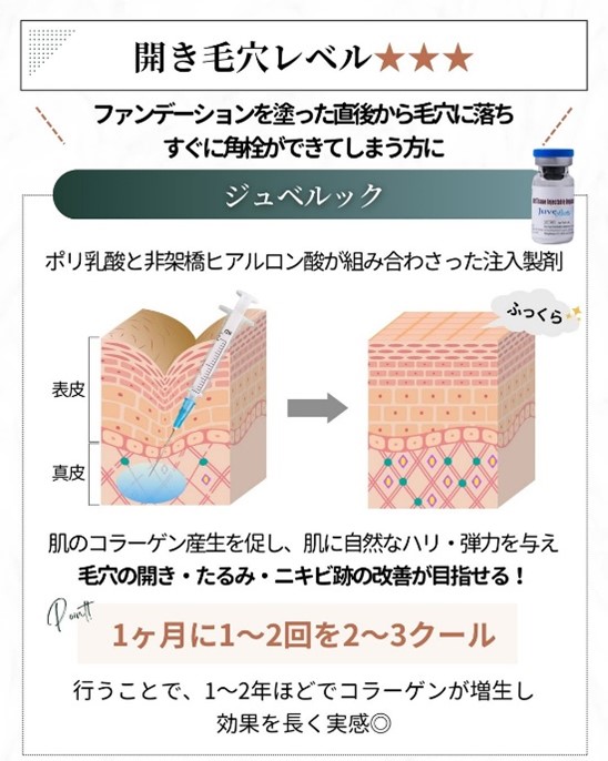 開き毛穴レベル3