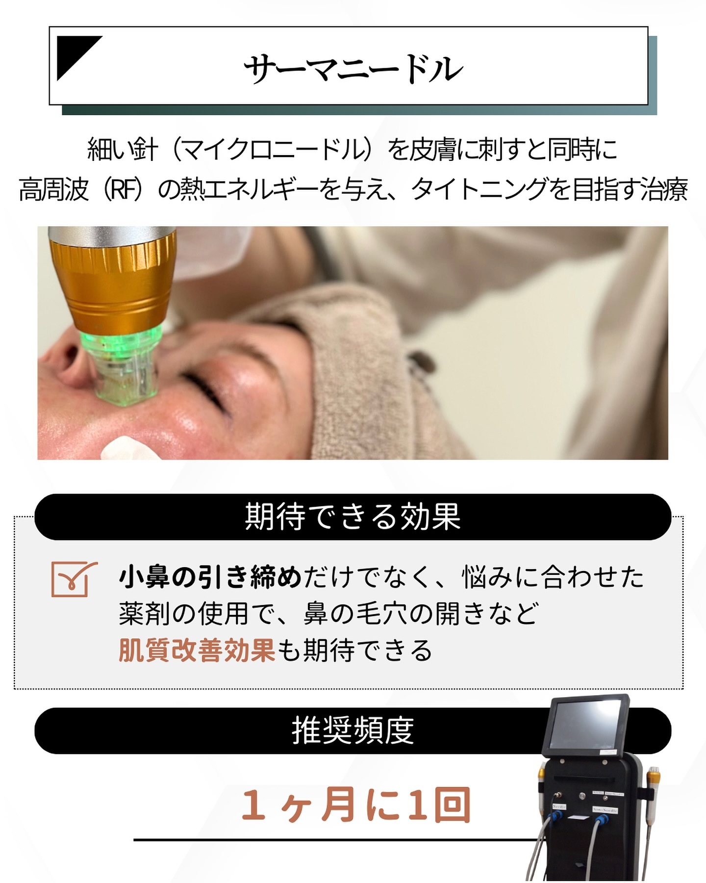 サーマニードル