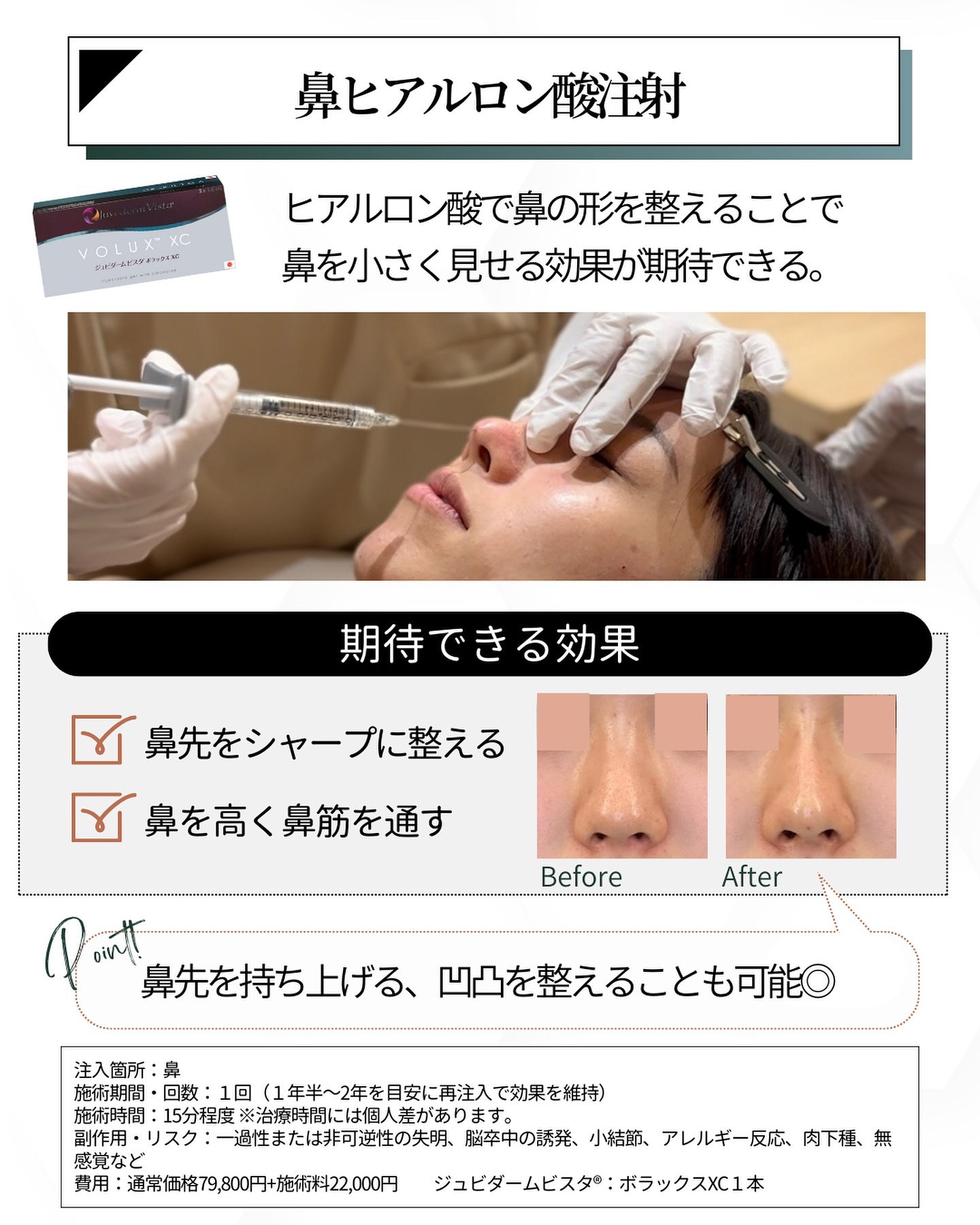 鼻ヒアルロン酸