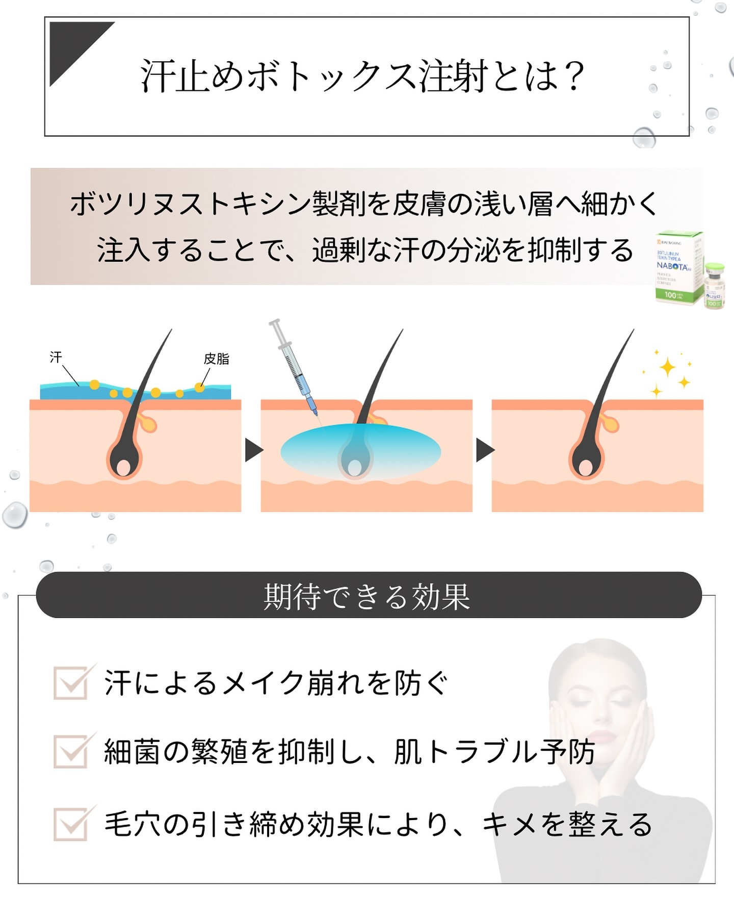 汗止めボトックス注射 効果
