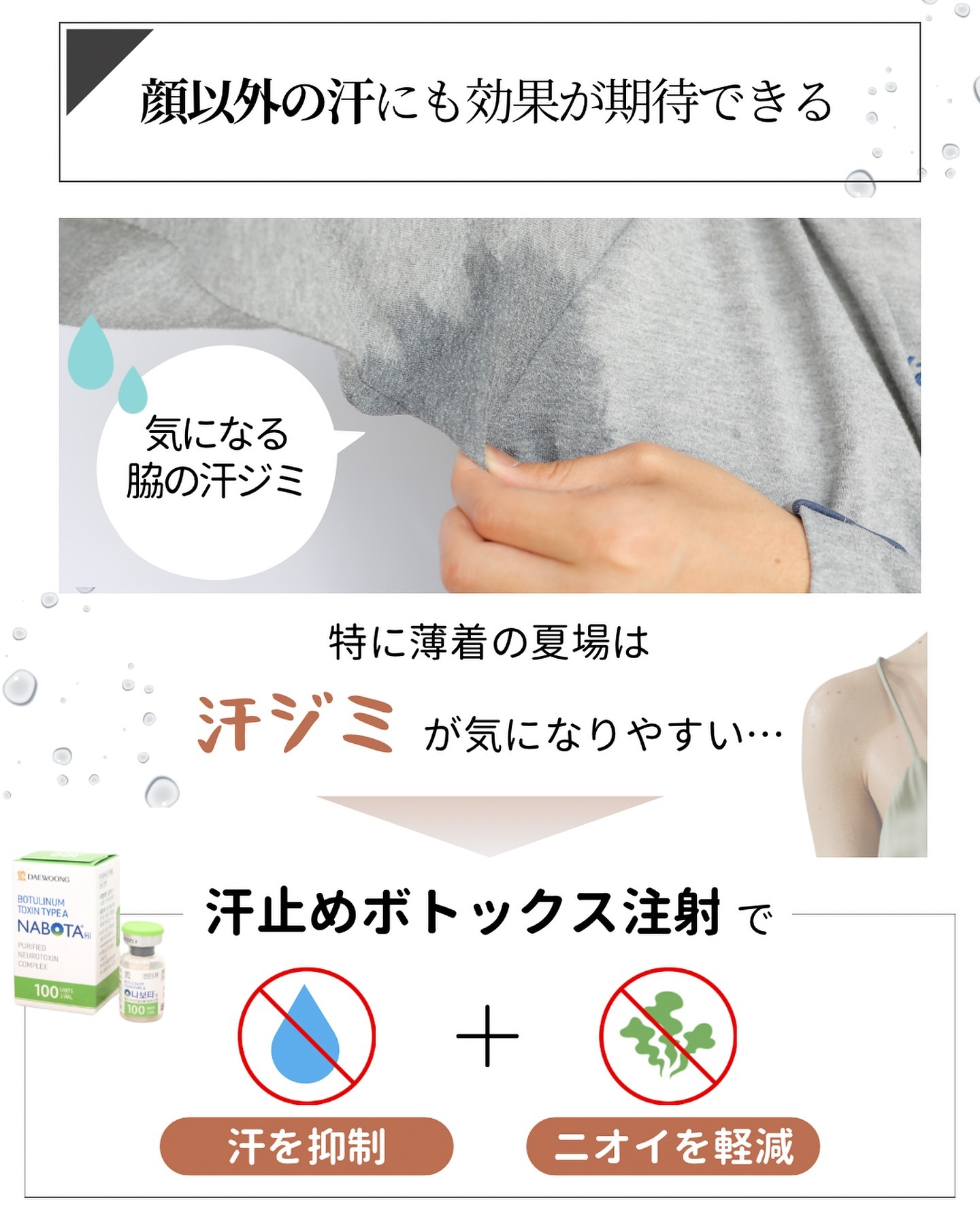 脇 汗止めボトックス注射