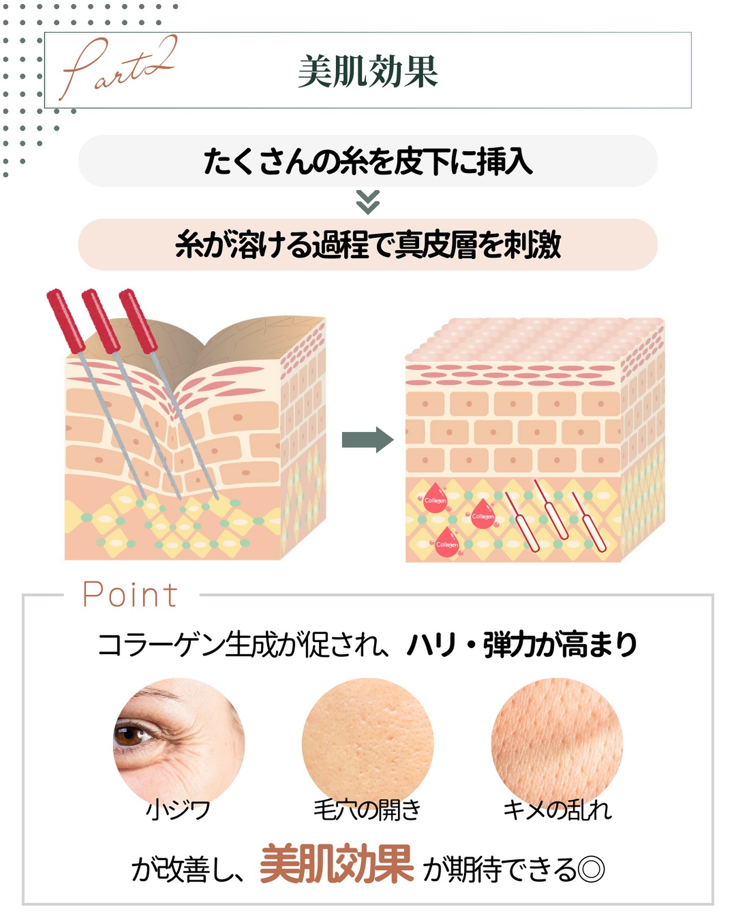 ショッピングリフト　魅力　美肌効果