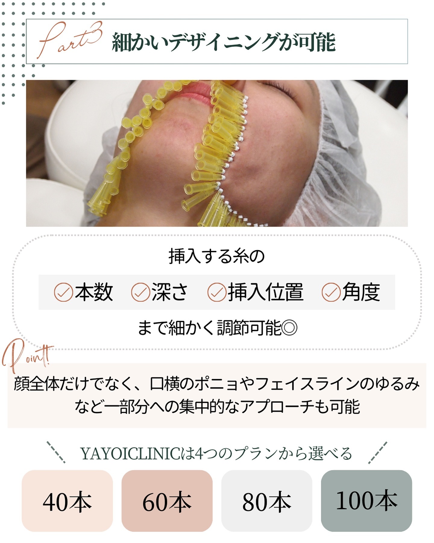 ショッピングリフト　魅力　デザイン