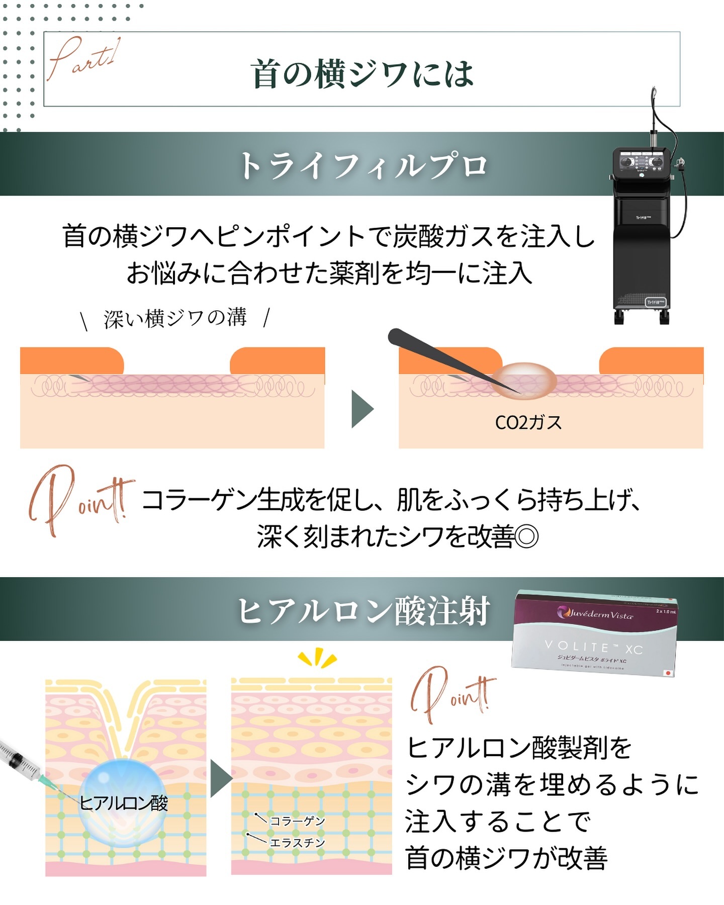 トライフィルプロとヒアルロン酸注射