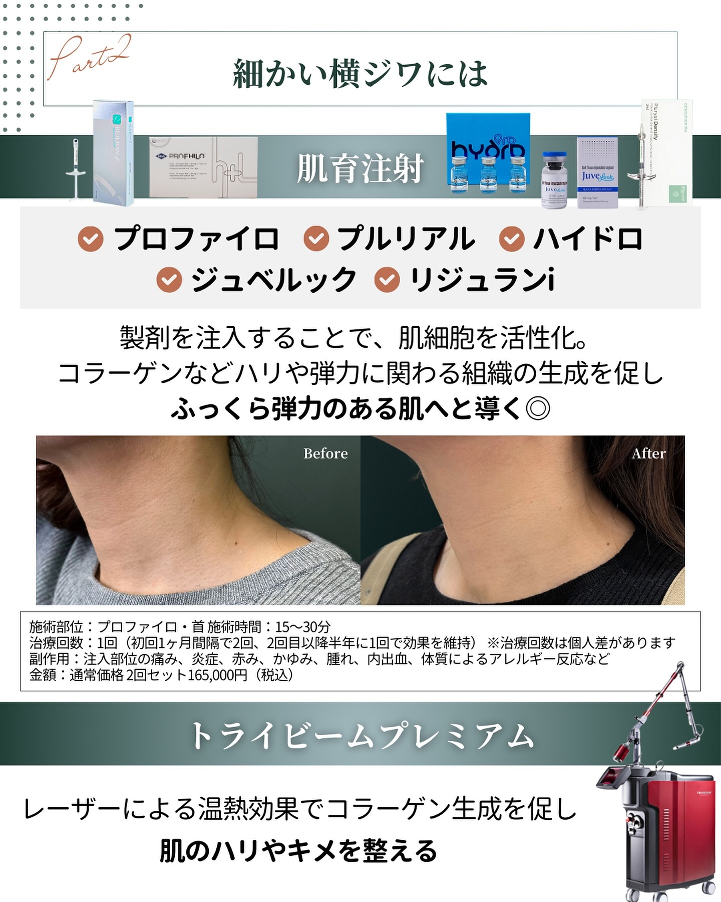 肌育注射とトライビームプレミアム