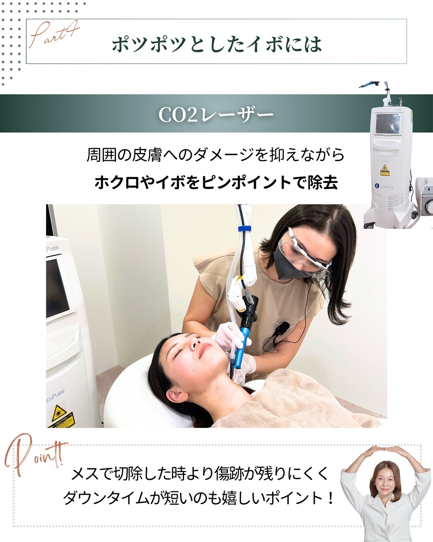 CO2レーザー