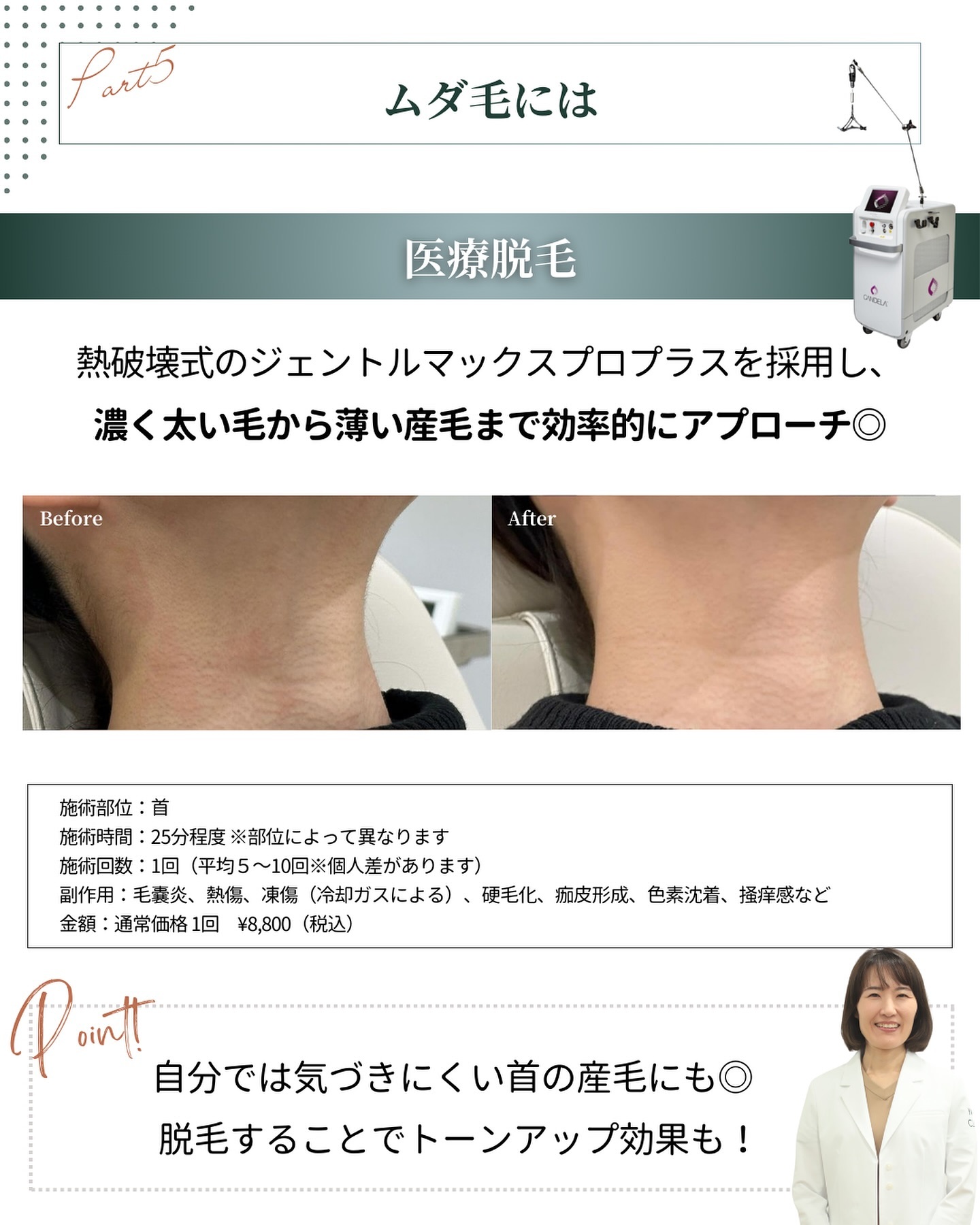 医療脱毛